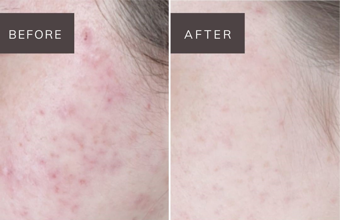 noon before and after