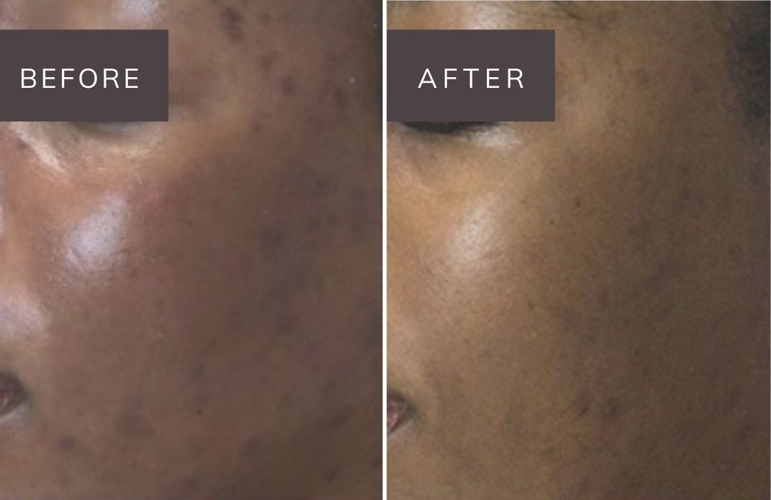 noon before and after